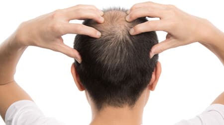 【薄毛対策の具体的な方法＆専門家のアドバイス】栄養バランスからストレス管理まで 健やかな髪を取り戻すための総合的アプローチ